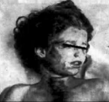 Mary Phagan autopsy photograph